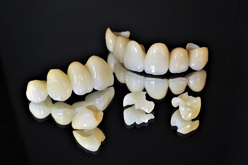 ジルコニアセラミッククラウン