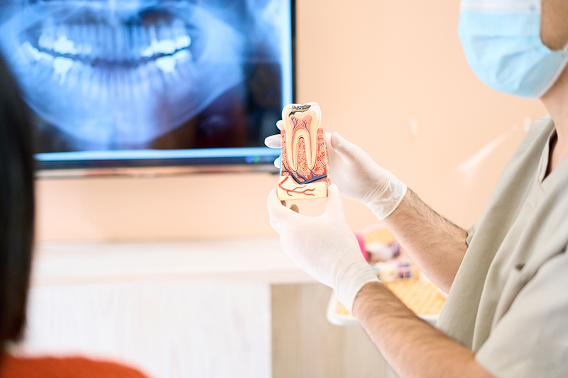 予防歯科で行う主なケア